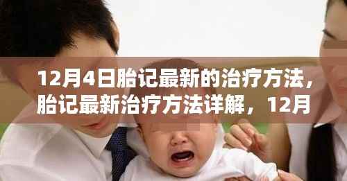 最新胎记治疗方法详解,12月指南,初学者也能轻松掌握的全新疗法