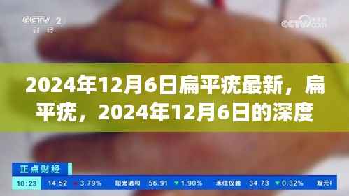 扁平疣深度观察,回顾与影响分析