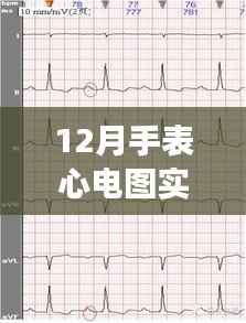 12月手表心电图监测,静谧时光中的自然探索之旅
