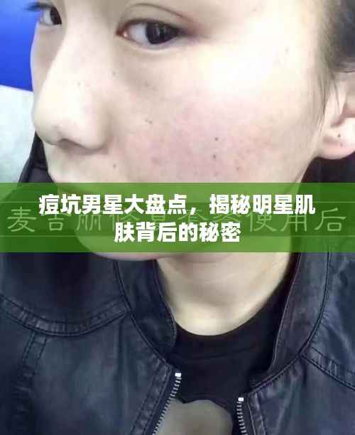 痘坑男星大盘点,揭秘明星肌肤背后的秘密