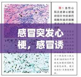 感冒突发心梗,感冒诱发心梗