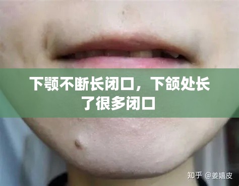 下颚不断长闭口,下颌处长了很多闭口