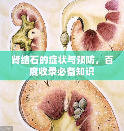 肾结石的症状与预防,百度收录必备知识
