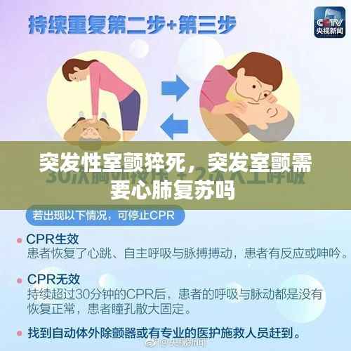 突发性室颤猝死,突发室颤需要心肺复苏吗