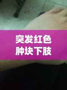 突发红色肿块下肢,下肢浮肿有红点